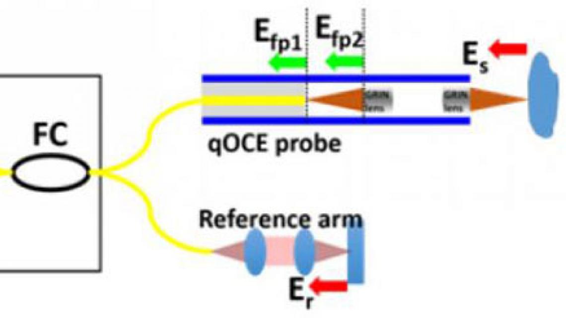 Quantitative Optical Coherence Elastography (qOCE)